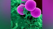 Health News | Research Finds Bacteria That Increase Risk of Pancreatic Cancer