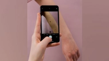 Science News | Researchers Study Why Moles Become Melanomas