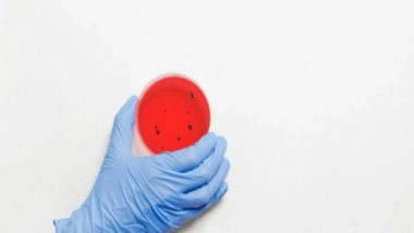 Science News | Study Targets Mouse's Own Cells to Treat Pneumonia