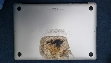 Apple MacBook Pro 15-Inch Model Catches Fire, User Suffers Minor Injuries