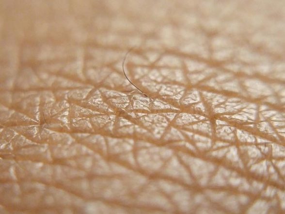 Health News | Skin Infections Can Cause Rheumatic Fever: Study - Vimarsana News