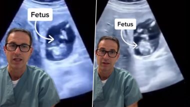 Watch Video of Foetus Growing Inside A Woman's Liver In Extremely Rare Ectopic Pregnancy Case in Canada