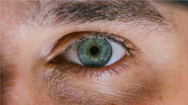 Glaucoma, a Leading Cause of Irreversible Blindness