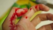 Science News | Study Finds How Immune Cells Are Controlled During Wound Healing