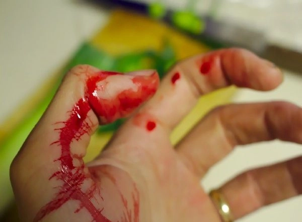 Science News | Study Finds How Immune Cells Are Controlled During Wound Healing