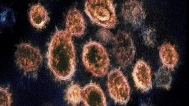 World News | Seegene to Export 1.7 Million Doses of COVID-19 Test Reagent to Israel