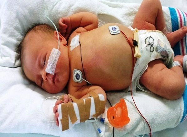 Research Reveals Family of Kids With Life-Threatening Diseases More Likely To Suffer Mentally & Physically