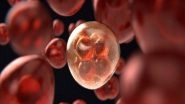 Health News | Study Suggests Lymphoma Cell Metabolism Might Provide New Cancer Target