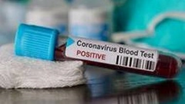 India News | 69 Medical Students, Staff Test COVID Positive in Hyderabad's Osmania Hospital