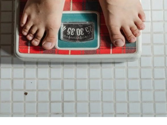 Health News | Study Looks at Impact of Obesity on Heart of Young Obese Children - Vimarsana News