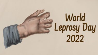 World Leprosy Day 2022 Date & Significance: What Is Leprosy? Know More About the Symptoms and Prevention Methods