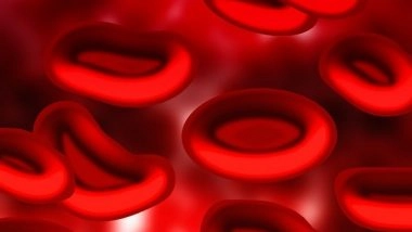 Health News | Research Suggests Blood Cancer Can Be Stopped by Targeting Bone Cells