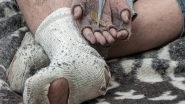 Health News | Study Finds Day Care Centres Were Hit the Hardest by COVID-19 Pandemic