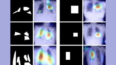 India News | IIT Jodhpur Researchers Develop COVID-19 Diagnosis Technique Using Chest X-ray Images