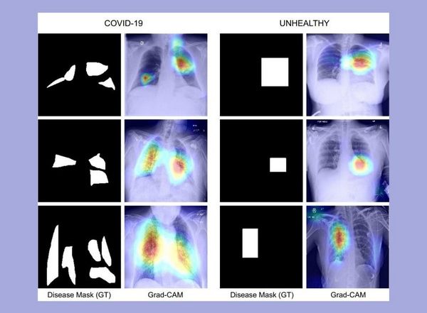 India News | IIT Jodhpur Researchers Develop COVID-19 Diagnosis Technique Using Chest X-ray Images