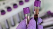 Science News | ALS May Now Be Diagnosed with Simple, Reliable Blood Tests: Study