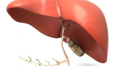 Science News | Study Examines Development of Fatty Liver Disease Under Healthy Diet