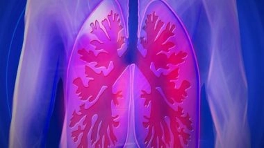 Health News | Scientists Find Potential Diagnostic and Therapeutic Target for Lung Cancer