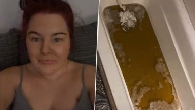 'Looking Like Shrek' Watch Viral Video of Mental Health Support Worker As Her Skin Turns Green After Using Fake Tan!