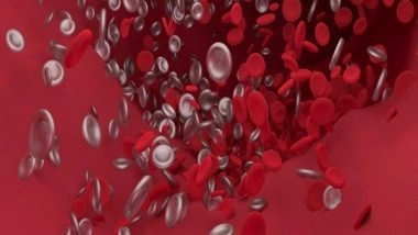 Health News | Mechanical Blood Clot Removal Showed Positive Results in Half of Stroke Patients: Study