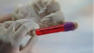 Health News | COVID-19 Less Severe in Fully Vaccinated People: Study