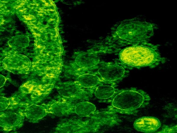 Health News | Antibiotics After Birth Affects Gut Microbes of Babies, Study Finds - Vimarsana News