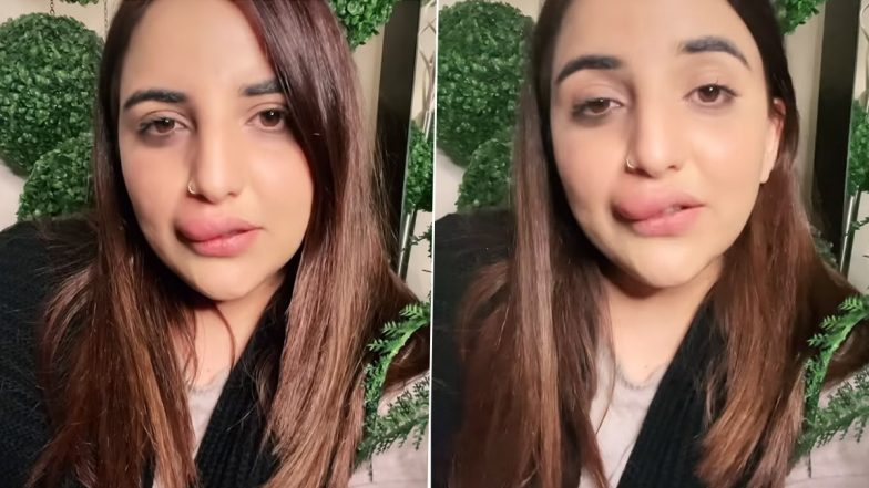 Watch: Pakistani TikTok Star Hareem Shah Shows Her Swollen Lips Due to Incomplete Filler Procedure, Says FIA Froze her Bank Account