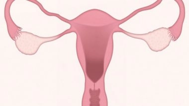 Health News | Study Reveals Secret Hideouts of Ovarian Cancer