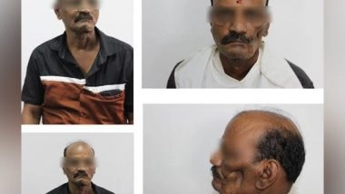Business News | Specialized Silicone Prosthesis Procedure at SRM Kattankulathur Dental College Helps Quick Restoration of Patients with Facial Defect