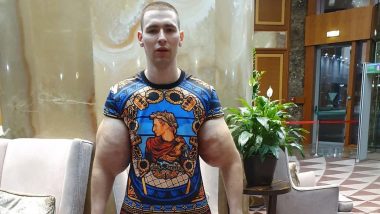 Russian 'Popeye,' Kirill Tereshin's Big Balloon Arms That Are Artificially Pumped By Oil Injections Leave Netizens Worried!