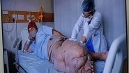India News | Surgery Helps Delhi Man Bedridden with 45-kg Elephantiasis Leg Walk for First Time in 10 Years