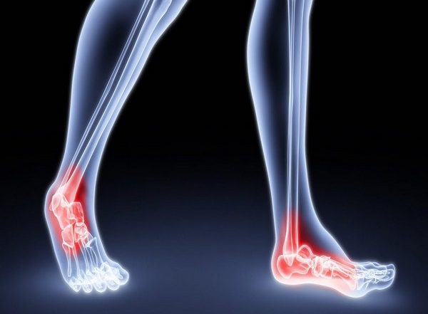 India News | Ayush Ministry to Start Phase-III Clinical Trial on Efficacy of Ayurveda in Treatment of Rheumatoid Arthritis