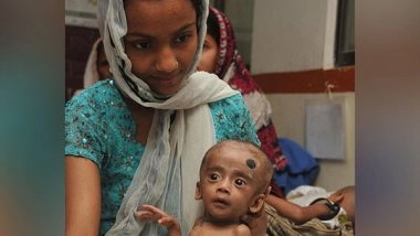 Business News | Need for Accelerated Community Program to Counter SAM as Pandemic Ebbs: CMAM Association