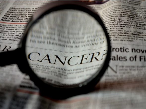 Health News | Researchers Develop New MRI Tool to Detect, Track Progression of Cancer - Vimarsana News
