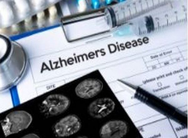 Health News | Ignoring Cholesterol, Glucose Levels at 35 May Get Chance of Alzheimer's Disease: Study