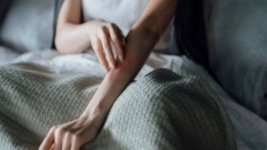 Science News | Researchers Introduce Painless, Reliable Test to Diagnose Skin Allergies