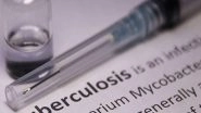 Health News | Different Strains of Tuberculosis Can Attack Lungs, Finds Study