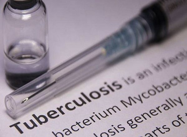 Health News | Different Strains of Tuberculosis Can Attack Lungs, Finds Study