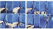 Business News | Doctor at Sakra World Hospital Invents a New Form of Arthroscopy Knot - The Banarji's Knot