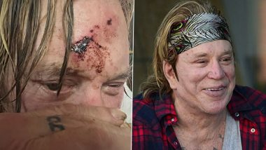 Mickey Rourke Shares Gruesome Pictures of His Forehead Injury, Says ‘Looks like My Skateboarding Days Are Over’