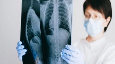 Science News | Researchers Discover New Cell Type in Human Lungs, May Play Role in Human Lung Diseases