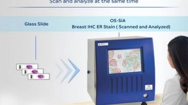 Business News | OptraSCAN's Artificial Intelligence-equipped Digital Pathology Scanner OS-SiA Granted US Patent for Scanning, Indexing and Analyzing of the Tissue Area at the Same Time