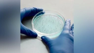 Environment News | Scientists Discover New Type of 'plastic-loving Bacteria'