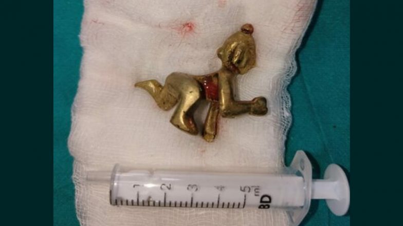 Karnataka: Lord Krishna Idol Surgically Removed From Man’s Food Pipe After He Swallows It Along With Holy Water