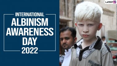 International Albinism Awareness Day 2022 Date, History & Significance: What Is Albinism? Everything To Know About the Day Dedicated to the Human Rights of Persons With Albinism