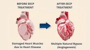 Business News | Know Why EECP is an Alternative to Bypass Surgery