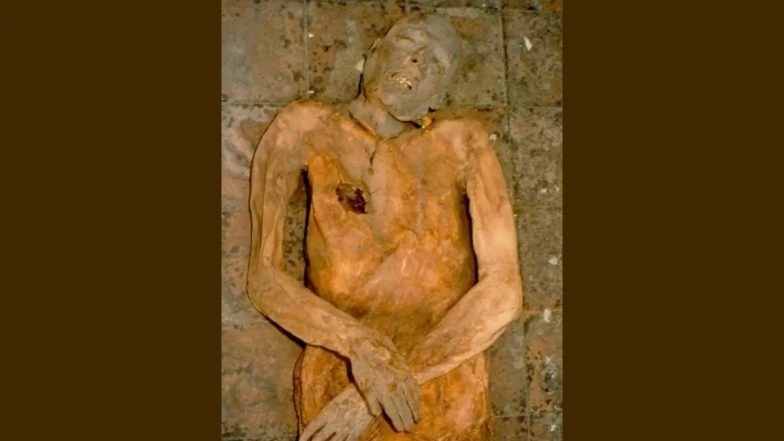 Canada: Ancient Genome of E Coli Reconstructed Using Gallstone of A 16th Century Italian Mummy