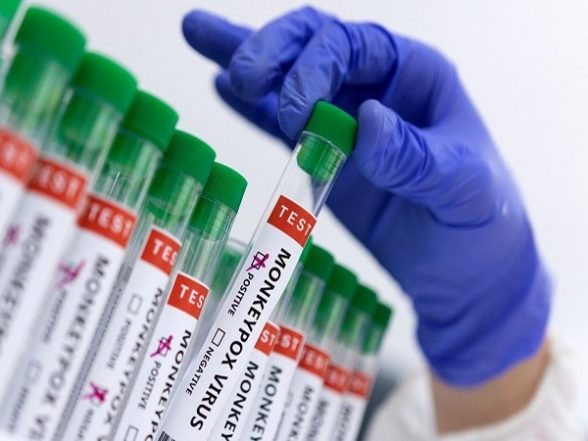 World News | EU Delivers First Batch of Monkeypox Vaccines to Spain - Vimarsana News