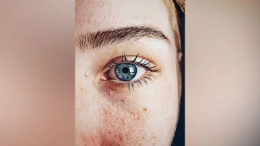 Science News | Eyes Could Signal Neurodevelopmental Disorders: Study