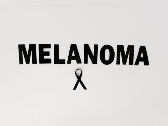 Health News | Researchers Find Molecular Factors to Treat Melanoma Skin Cancer - Vimarsana News